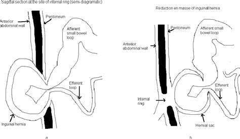 Figure 1 From Biomedical Imaging And Intervention Journal Reduction En