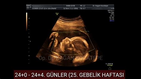 Haftalik Aylik Gebel Kte Kiz Bebek Nasil G R N R Renkl