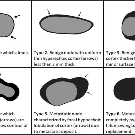 Drawings And Definitions Of The Different Types Of Nodes Proposed By