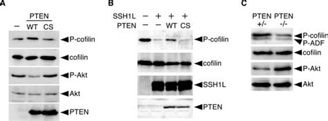 Pten Negatively Regulates Cofilin Dephosphorylation As Shown In A