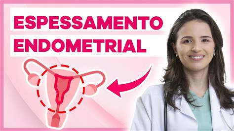 Espessamento endometrial é grave O que fazer YouTube