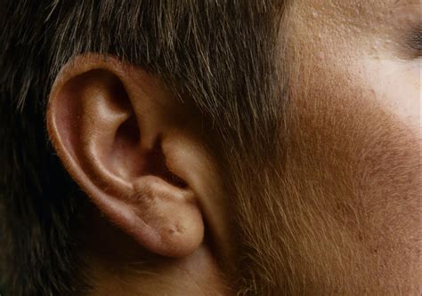 Blocked Ears A Guide To Types Causes And Treatment