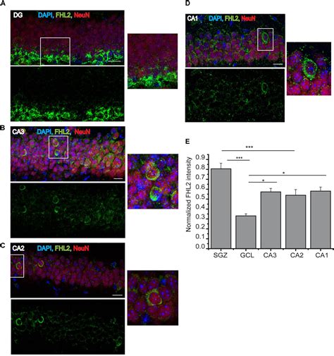 Frontiers Early Dendritic Morphogenesis Of Adult Born Dentate Granule