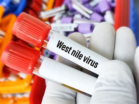 West Nile Virus: Causes, Symptoms, Diagnosis, Treatment