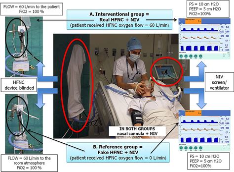 New Method Of Preoxygenation For Orotracheal Intubation In Patients