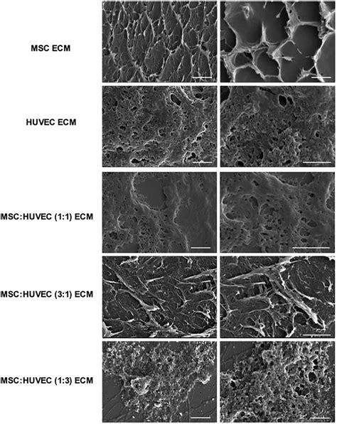 Scanning Electron Microscopy Images Of Ecm Derived From Mscs And Huvecs