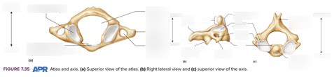 Vertebrae Atlas Axis Diagram Quizlet