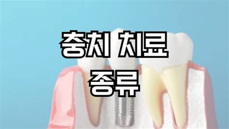 충치 치료 종류 가격 비용 장점 단점 치료방법 원인과 치료의 필요성 유지관리방법 부작용 주의사항 치료 단계별 완벽 가이드