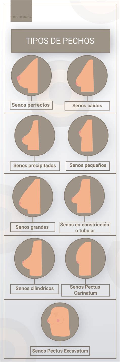 Si Quieres Conocer Los Tipos De Senos Que Existen Haz Clic En Esta