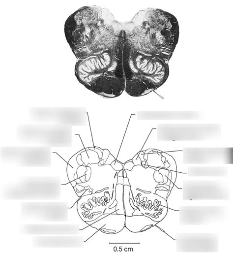 Rostral Medulla Diagram Quizlet