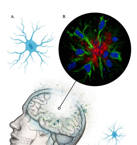 Javier Rubio Serrano Papel De La Microgl A En La Enfermedad De Alzheimer