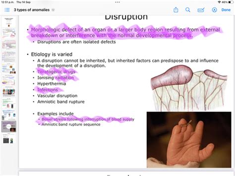 3 4 Types And Groups Of Anomalies Flashcards Quizlet