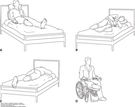 Mobility Short Term Position Slide 2 Flashcards Quizlet