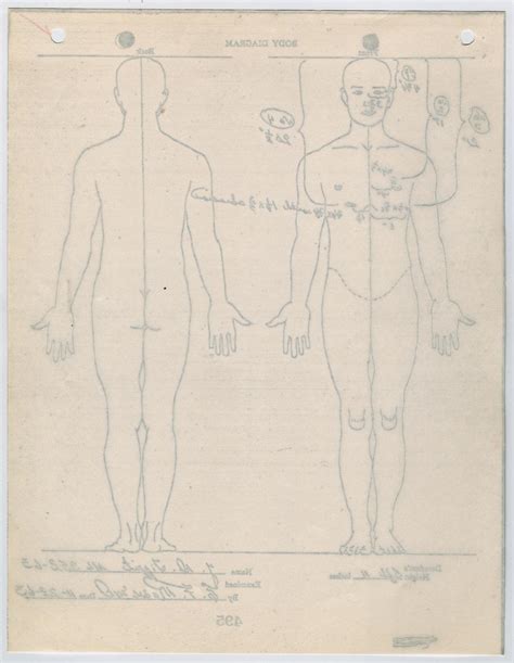 [Autopsy Report on Officer J. D. Tippit, by Earl F. Rose #2] - Page 30 ...