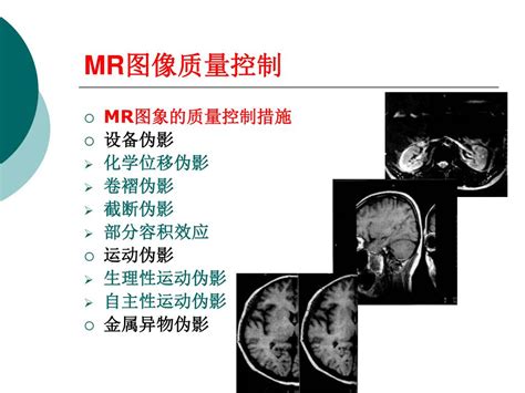 Ppt Mri The Basic Principles And Clinical Application Of