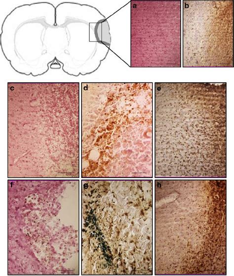 Representative Immunohistochemistry Of Photothrombotic Stroke Lesions