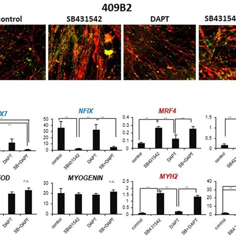 Effects Of SB431452 And DAPT1 On Differentiation Of HiPSC Derived