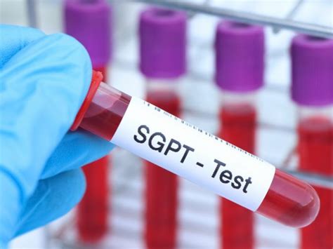 Danger Level Of Sgpt And Sgot Normal Range