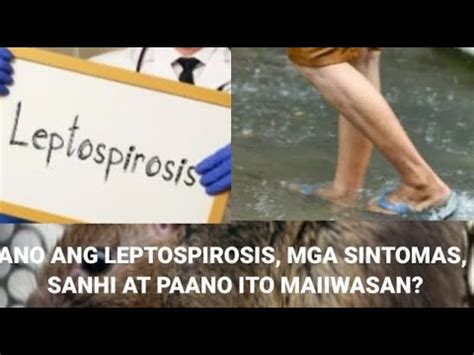 Leptospirosis Sakit Mula Sa Ihi Ng Daga Ano Ang Mga Sintomas At Sanhi