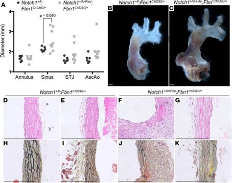 Exacerbated Aneurysm Phenotype Observed In Notch1 Fbn1 C1039g Download Scientific Diagram