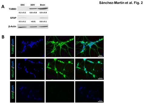 Expression Of Tubb3 Vglut1 And Gfap Proteins A Western Immunoblot