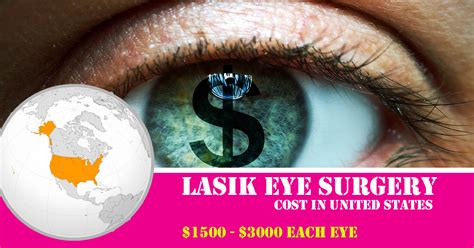 How Much Does Lasik Eye Surgery Cost (Cheap To High)? - Find Health Tips