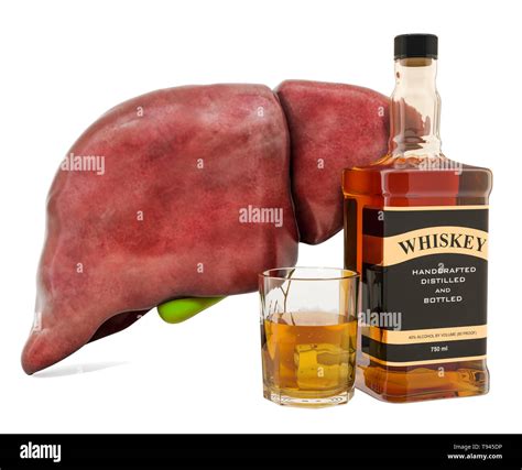 Alcohol-related liver disease, human liver with alcohol drink. 3D ...