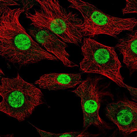 Subcellular Sap Bp The Human Protein Atlas