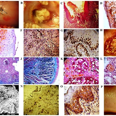 Modeling Of Tongue Squamous Cell Carcinoma In Rats Rat Tongue