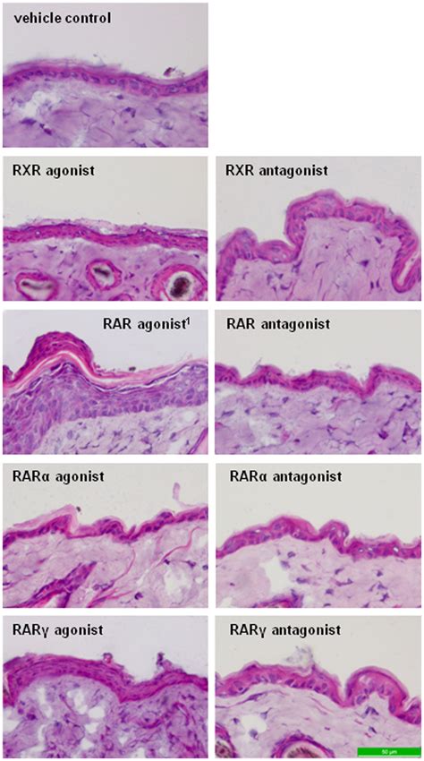 H E Stained Skin Sections Of Mice After Treatment With Retinoid