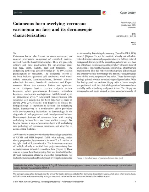 Pdf Cutaneous Horn Overlying Verrucous Carcinoma On Face And Its