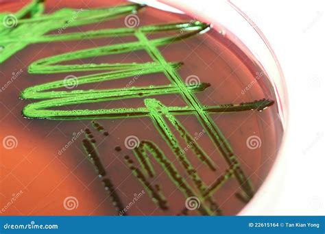 Microbiology - Bacteria Culture Stock Images - Image: 22615164