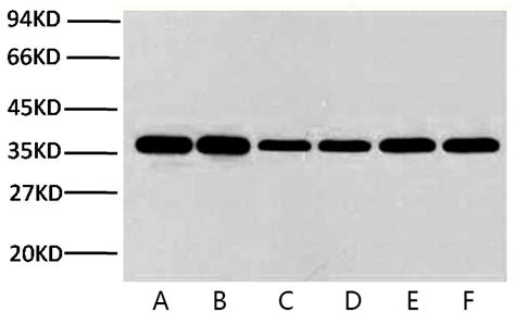 【β 肌動蛋白β Actin、gapdh和 β 微管蛋白 β Tubulin抗體套組】貨號 Ktd101 En