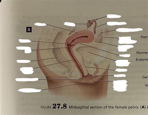 Midsagittal Section Of The Female Pelvis Diagram Quizlet