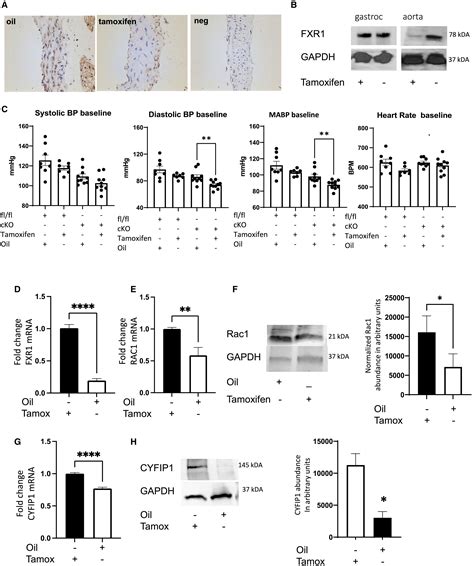 Fxr1 Regulates Vascular Smooth Muscle Cell Cytoskeleton Vsmc