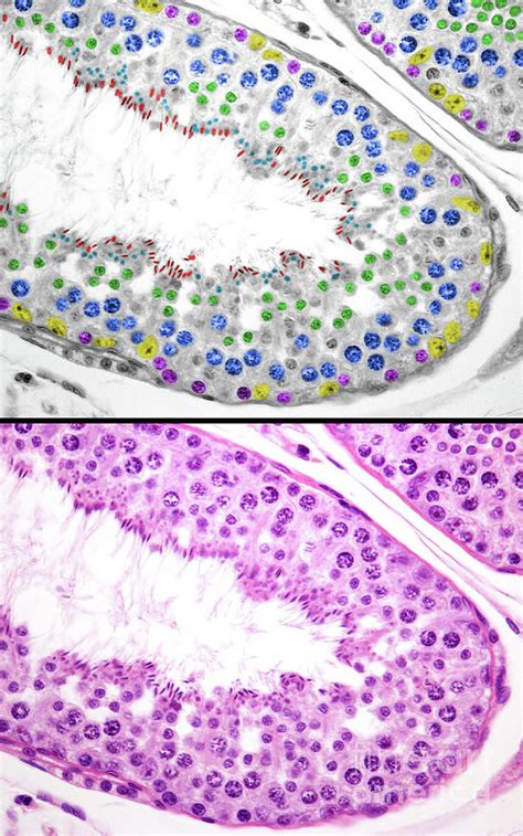 Spermatogenesis In Human Testicle By Jose Calvo Science Photo Library