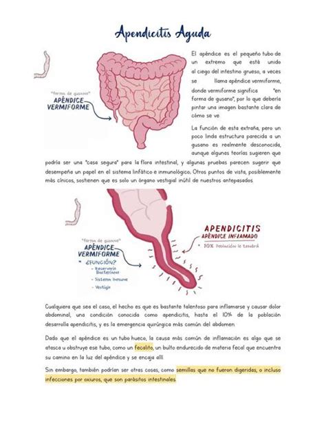 Apendicitis Aguda Ana Lilia Valle Udocz