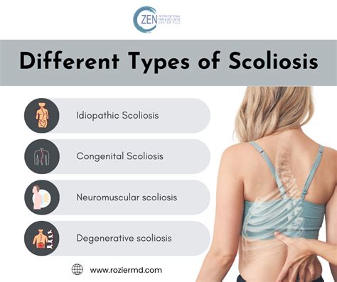 Scoliosis Treatment In Mansfield TX Why Need Early Intervention