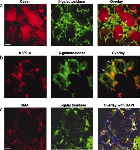 Interaction With The Mammary Microenvironment Redirects Spermatogenic