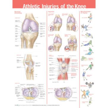 Athletic Injuries of the Knee Chart | Canada Clinic Supply