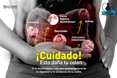 Aunque Son Deliciosos Son Letales Para Tu Colon Salud180