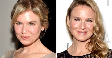 Renée Zellweger Surge Irreconhecível No Red Carpet Claudia