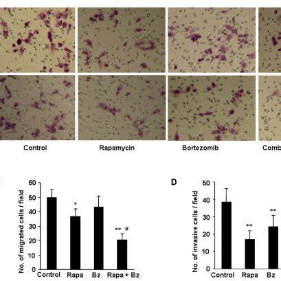 Effects Of Rapamycin And Bortezomib On Migration And Invasion Of