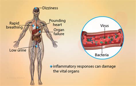 Health Condition Symptoms Causes Treatment And More