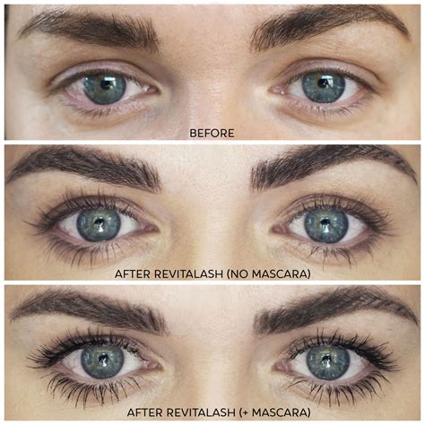 Revitalash Advanced Lash Growth Serum Full Review With Before And After Photos Laura Louise