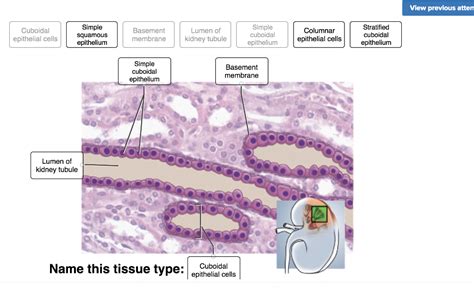 Solved Vlew previous atten Simple Simple squamous | Chegg.com