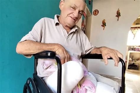 Grave error médico amputan la pierna equivocada a paciente de 66 años