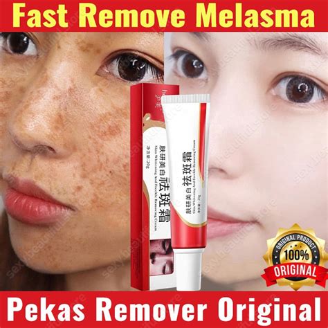 Melasma Cream Pekas Remover Original Collagen Pekas Freckles Remover