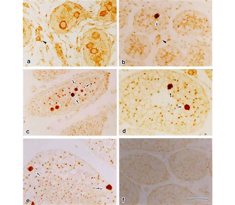 Immunohistochemical detection of Bax in developing mouse testes ... 