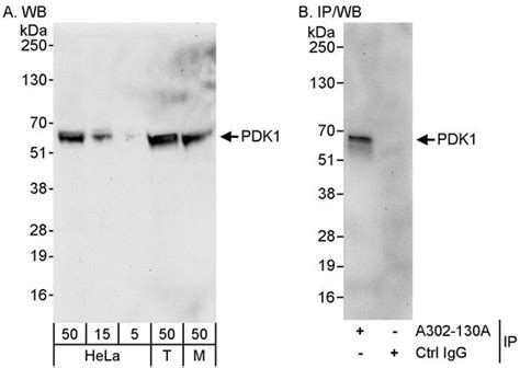 Pdpk1 Polyclonal Antibody A302 130a